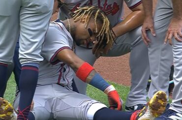 Acuña s'est déchiré le ligament croisé antérieur et ratera le reste de la saison