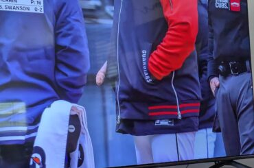 Superbe photo de la blessure au doigt de Stephen Voigt