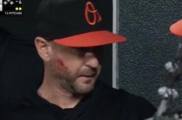 Craig Albernaz revient à l'abri après avoir reçu une fausse balle au visage